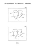 Mri Probe for Prostate Imaging diagram and image