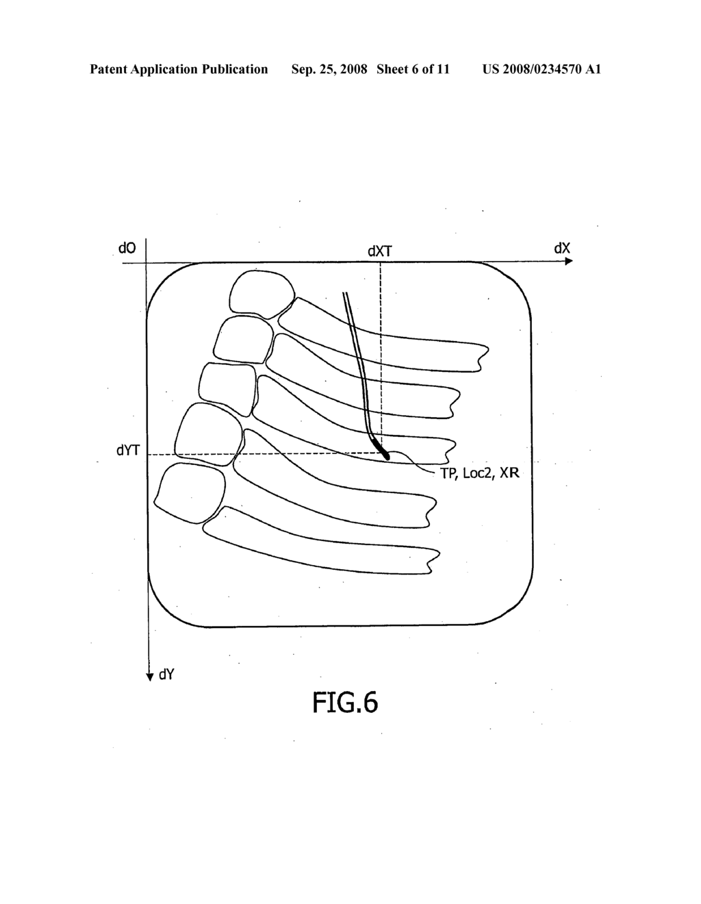 System For Guiding a Medical Instrument in a Patient Body - diagram, schematic, and image 07