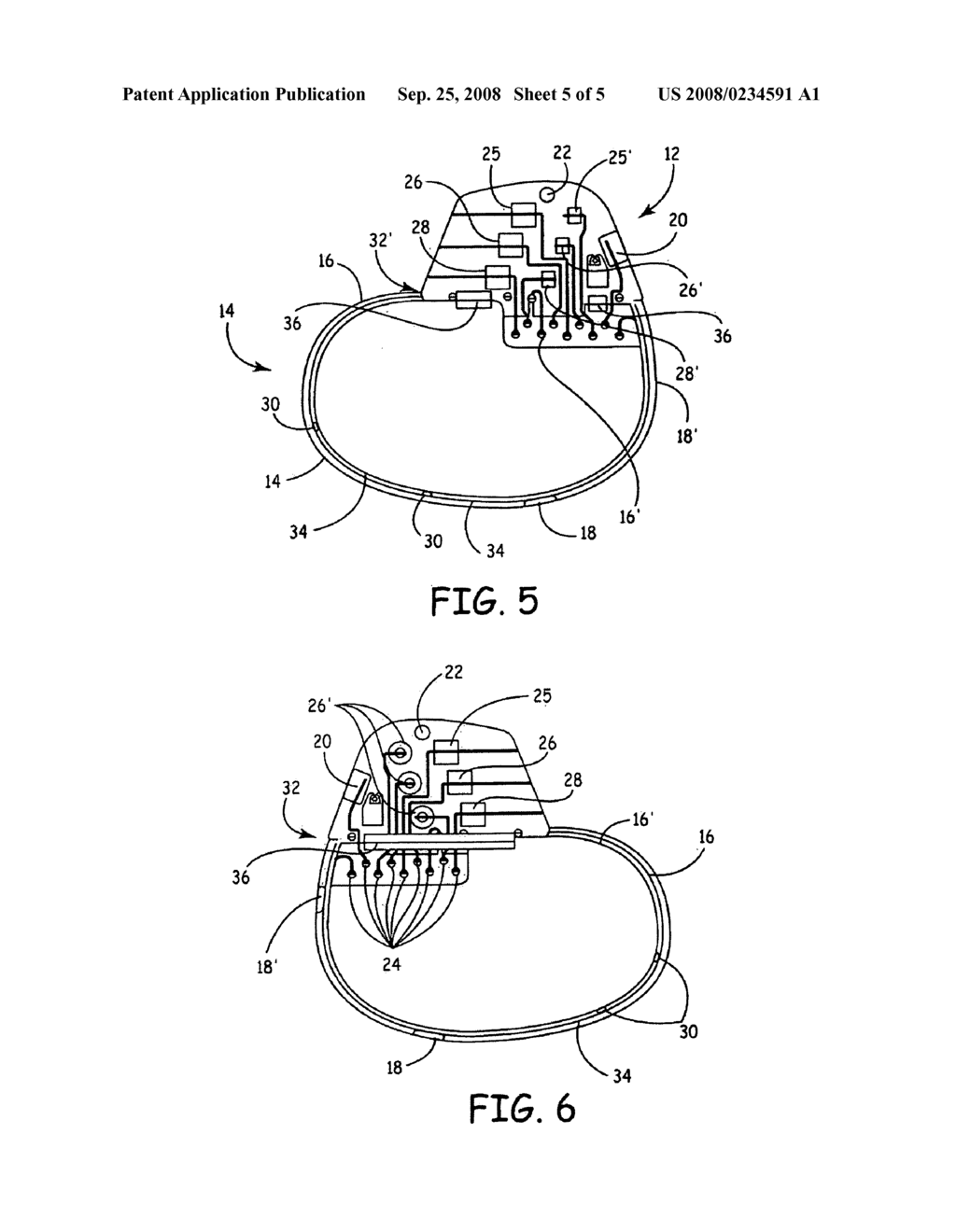 METHODS AND APPARATUS FOR PATIENT NOTIFICATION OF PHYSIOLOGIC EVENTS AND DEVICE FUNCTION - diagram, schematic, and image 06