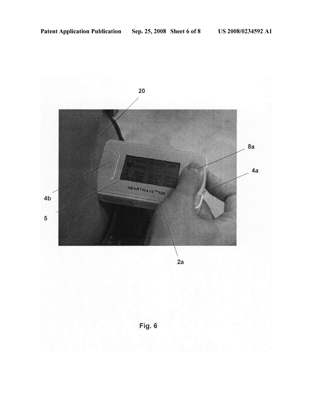 Method and apparatus for generating an electrocardiogram - diagram, schematic, and image 07