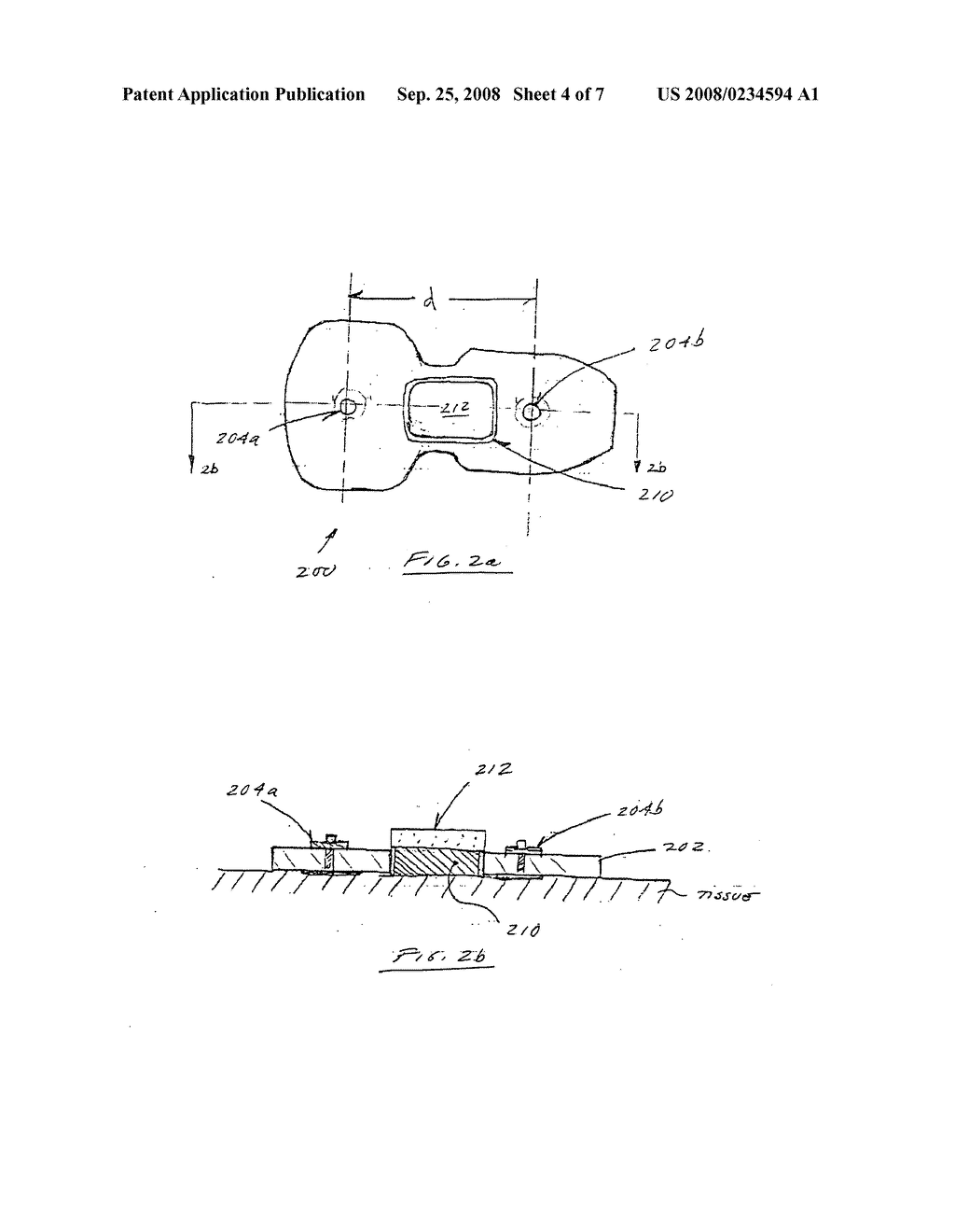 Methods and apparatus for enhanced fiducial point determination and non-invasive hemodynamic parameter determination - diagram, schematic, and image 05