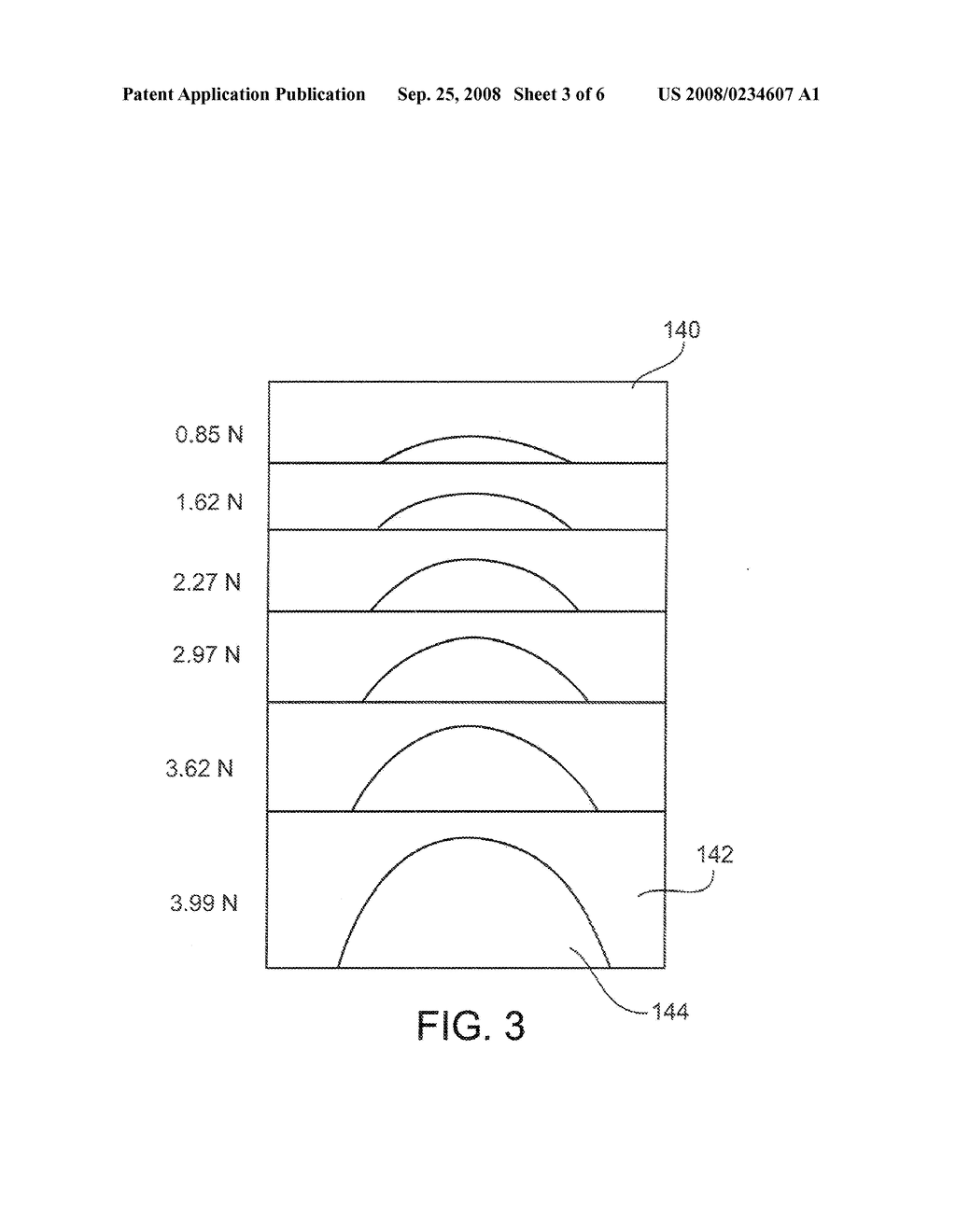 SKIN ELASTICITY MEASUREMENT - diagram, schematic, and image 04