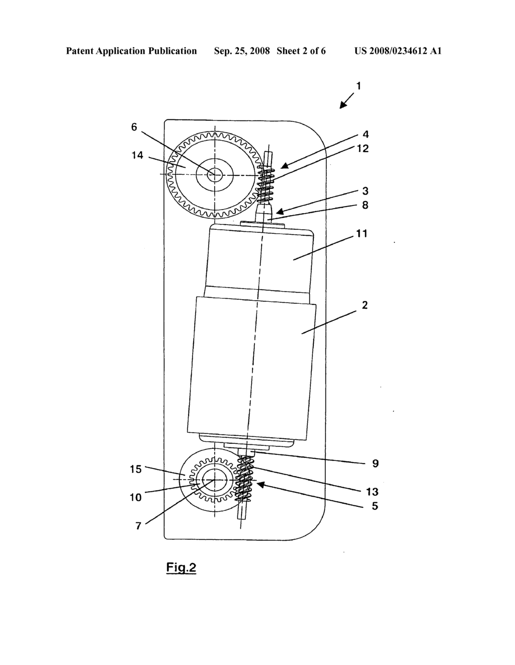 Massage Carriage - diagram, schematic, and image 03