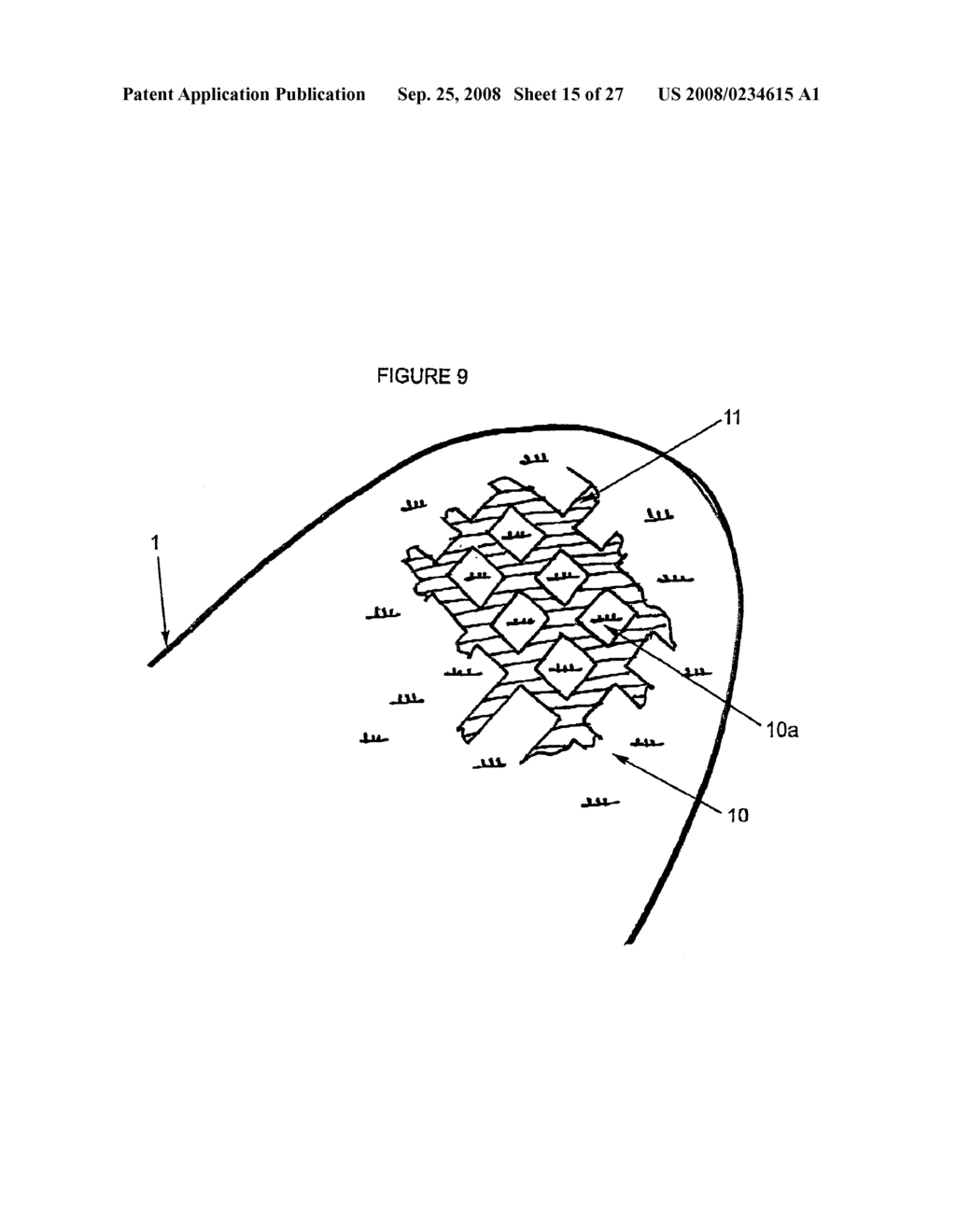 Limited Durability Fastening for a Garment - diagram, schematic, and image 16