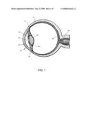 OCULAR IMPLANT WITH ANCHOR AND THERAPEUTIC AGENT diagram and image