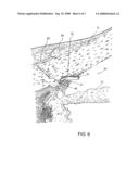 OCULAR IMPLANT WITH ANCHOR AND THERAPEUTIC AGENT diagram and image