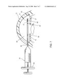 OCULAR IMPLANT WITH ANCHOR AND THERAPEUTIC AGENT diagram and image