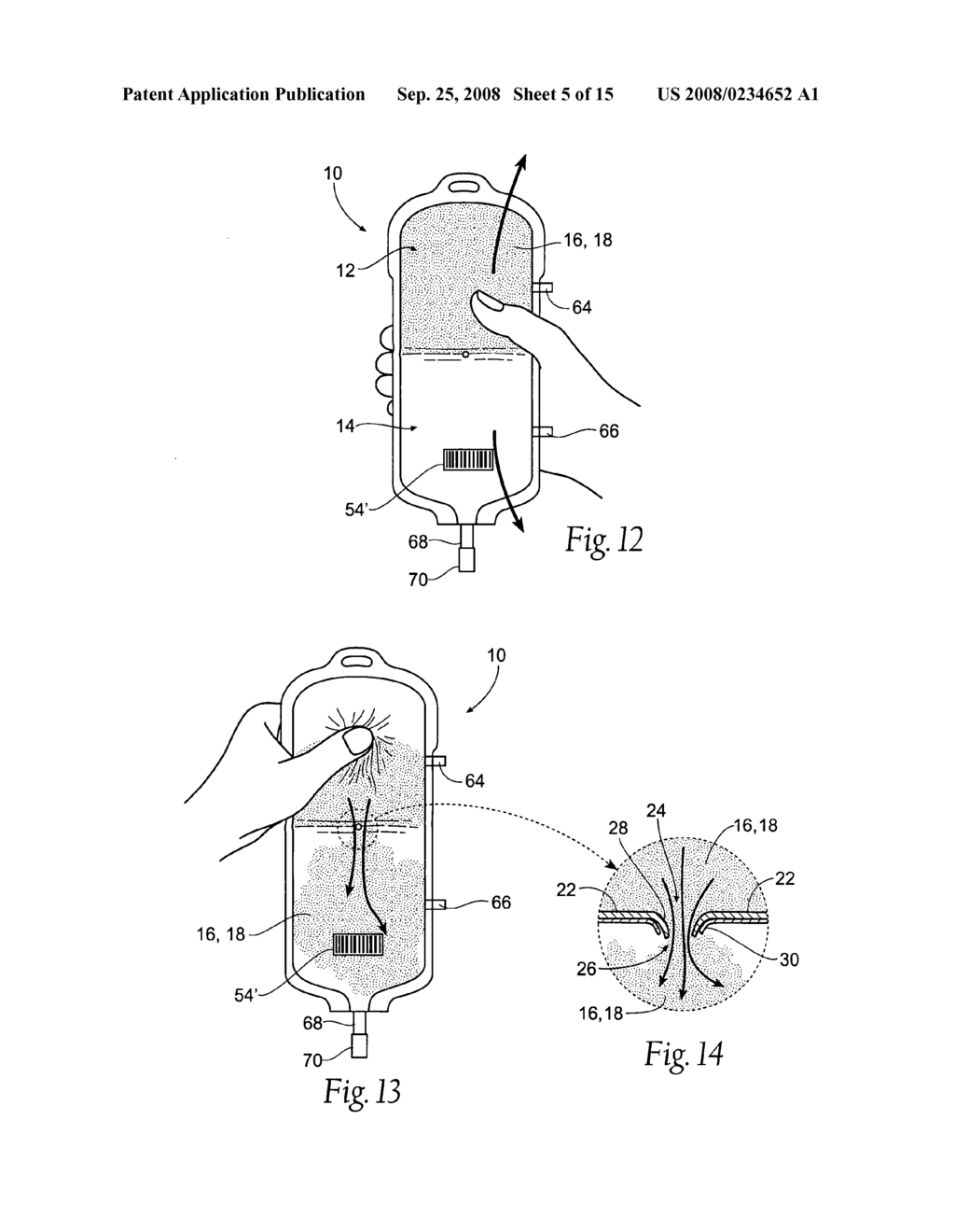 Apparatus and methods for making, storing, and administering freeze-dried materials such as freeze-dried plasma - diagram, schematic, and image 06