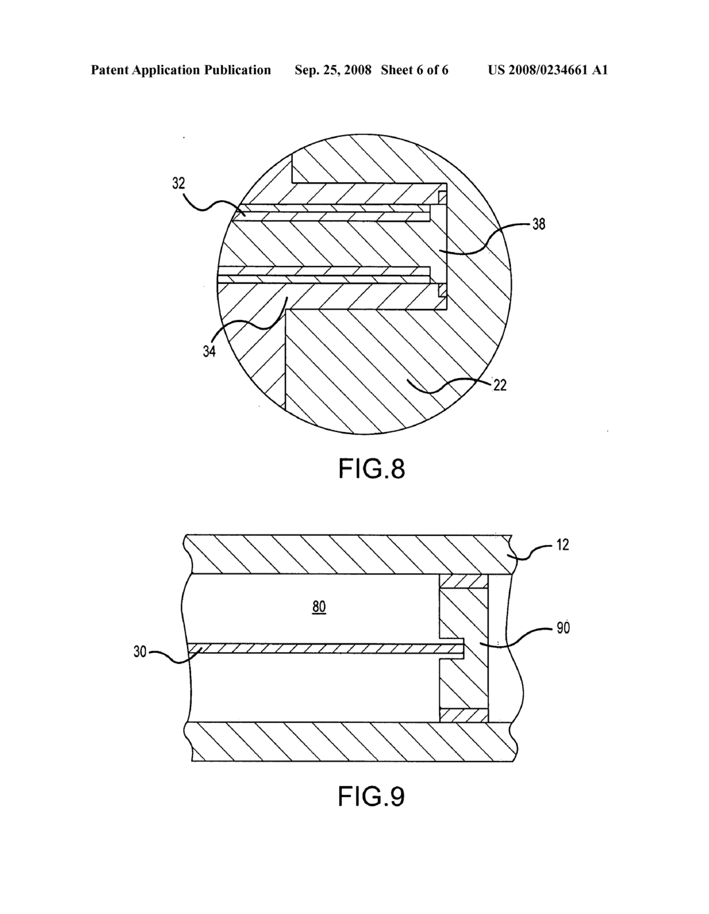 Catheter employing shape memory alloy shaping wire or pull wire and method of its manufacture - diagram, schematic, and image 07