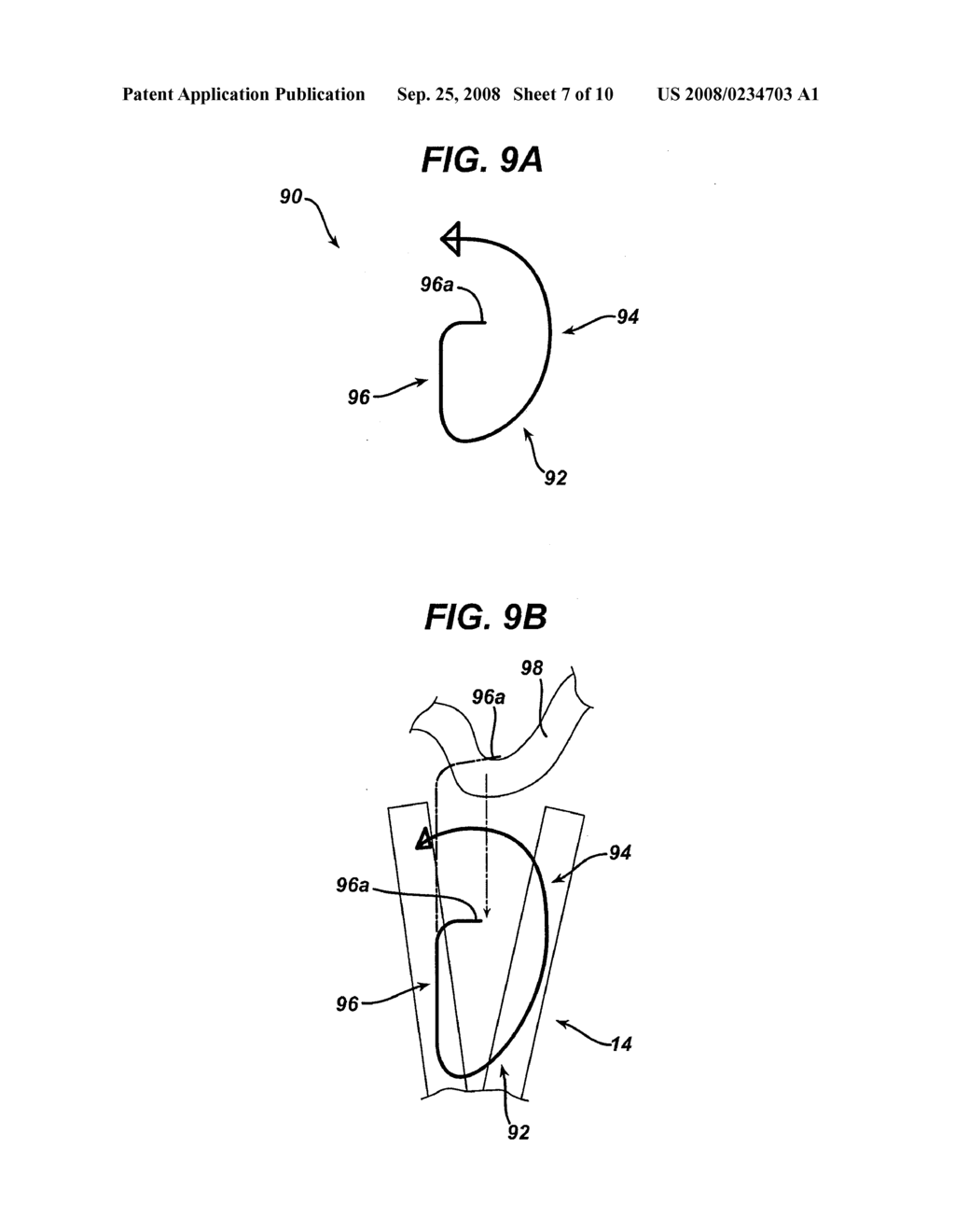 TISSUE APPROXIMATION SYSTEM - diagram, schematic, and image 08