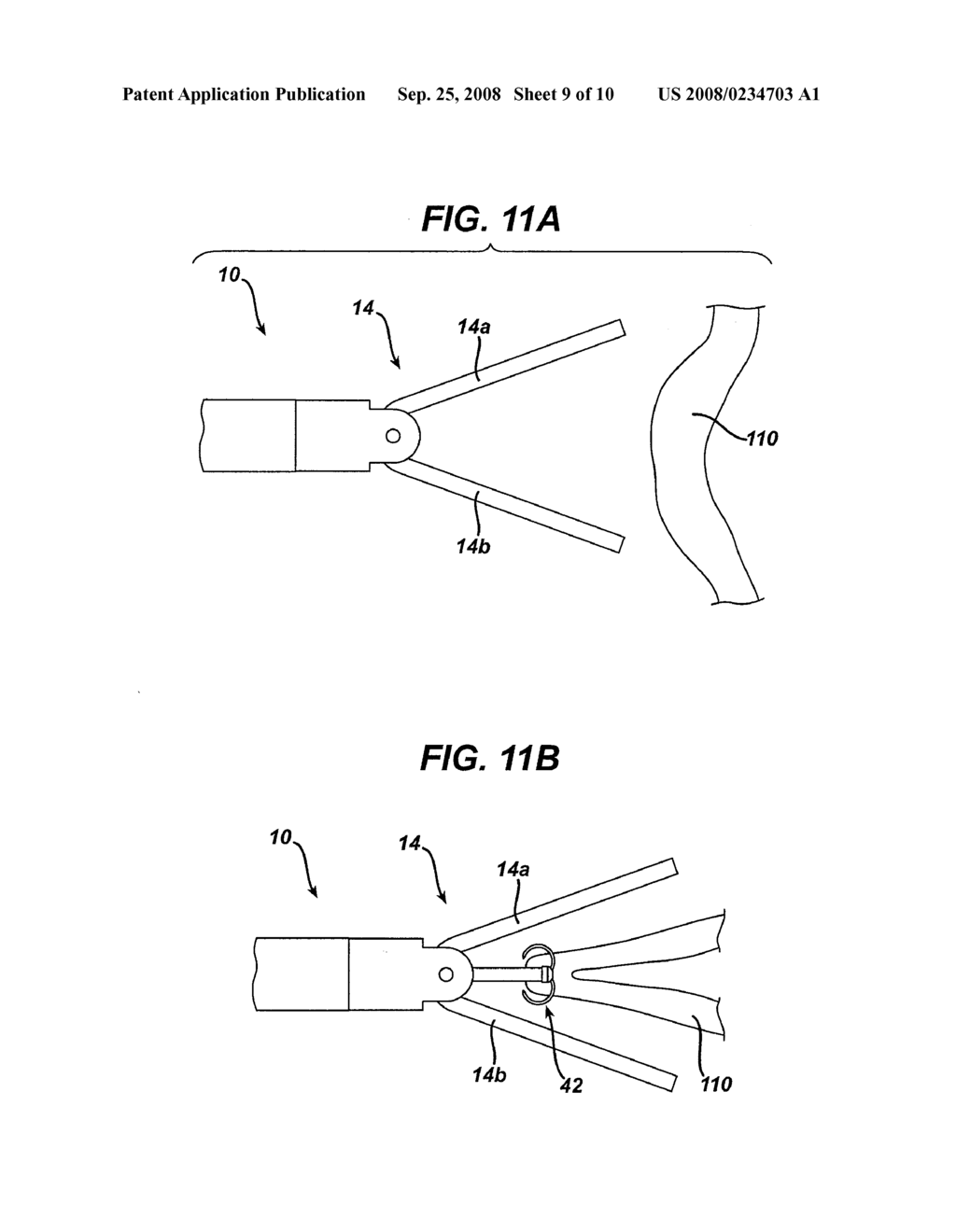 TISSUE APPROXIMATION SYSTEM - diagram, schematic, and image 10