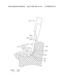 Ultrasonic surgical instruments diagram and image