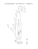 Ultrasonic surgical instruments diagram and image