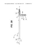 Tissue Extraction and Collection Device diagram and image