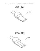 Tissue Extraction and Collection Device diagram and image