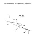 Tissue Extraction and Collection Device diagram and image