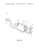 Tissue Extraction and Collection Device diagram and image