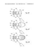 Devices, Systems and Methods for Treating Disorders of the Ear, Nose and Throat diagram and image