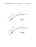 Devices, Systems and Methods for Treating Disorders of the Ear, Nose and Throat diagram and image