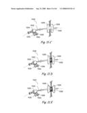 Devices, Systems and Methods for Treating Disorders of the Ear, Nose and Throat diagram and image