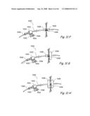 Devices, Systems and Methods for Treating Disorders of the Ear, Nose and Throat diagram and image