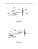 Devices, Systems and Methods for Treating Disorders of the Ear, Nose and Throat diagram and image