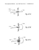 Devices, Systems and Methods for Treating Disorders of the Ear, Nose and Throat diagram and image