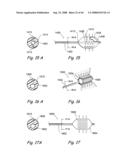 Devices, Systems and Methods for Treating Disorders of the Ear, Nose and Throat diagram and image