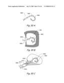 Devices, Systems and Methods for Treating Disorders of the Ear, Nose and Throat diagram and image