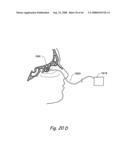 Devices, Systems and Methods for Treating Disorders of the Ear, Nose and Throat diagram and image