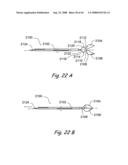 Devices, Systems and Methods for Treating Disorders of the Ear, Nose and Throat diagram and image