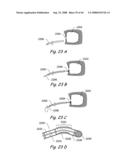 Devices, Systems and Methods for Treating Disorders of the Ear, Nose and Throat diagram and image