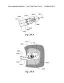 Devices, Systems and Methods for Treating Disorders of the Ear, Nose and Throat diagram and image