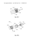 Devices, Systems and Methods for Treating Disorders of the Ear, Nose and Throat diagram and image