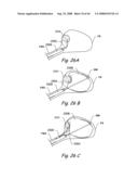 Devices, Systems and Methods for Treating Disorders of the Ear, Nose and Throat diagram and image