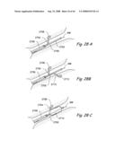 Devices, Systems and Methods for Treating Disorders of the Ear, Nose and Throat diagram and image