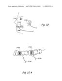 Devices, Systems and Methods for Treating Disorders of the Ear, Nose and Throat diagram and image