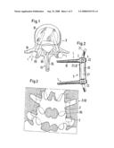 PEDICLE SCREW FOR INTERVERTEBRAL SUPPORT ELEMENTS diagram and image