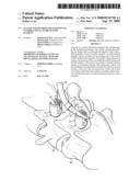 SYSTEM AND METHOD FOR INSERTION OF FLEXIBLE SPINAL STABILIZATION ELEMENT diagram and image