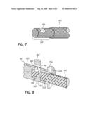 SPINAL STABILIZATION SYSTEM WITH RIGID AND FLEXIBLE ELEMENTS diagram and image