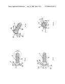 Anterior vertebral plate with quick lock screw diagram and image