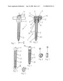 Pedicle Screw diagram and image