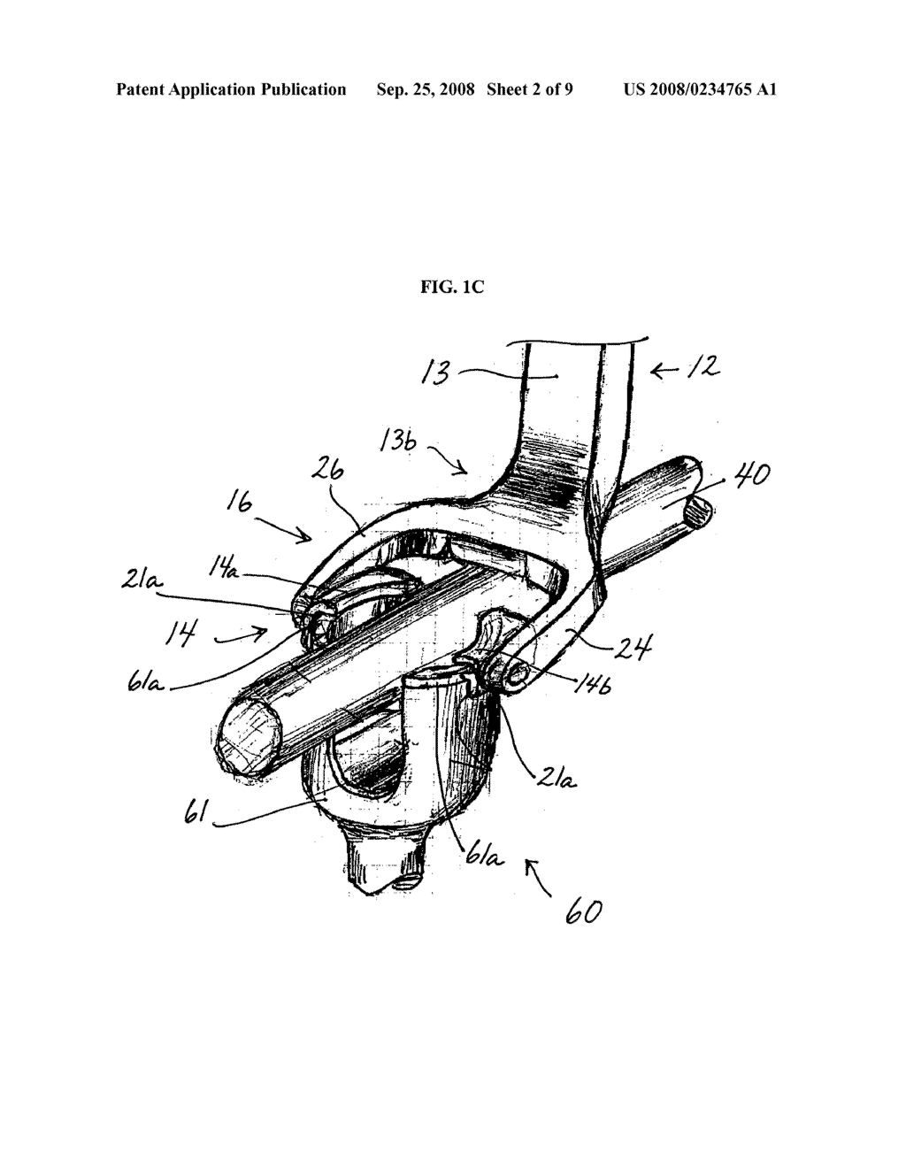 ROD REDUCTION METHODS AND DEVICES - diagram, schematic, and image 03