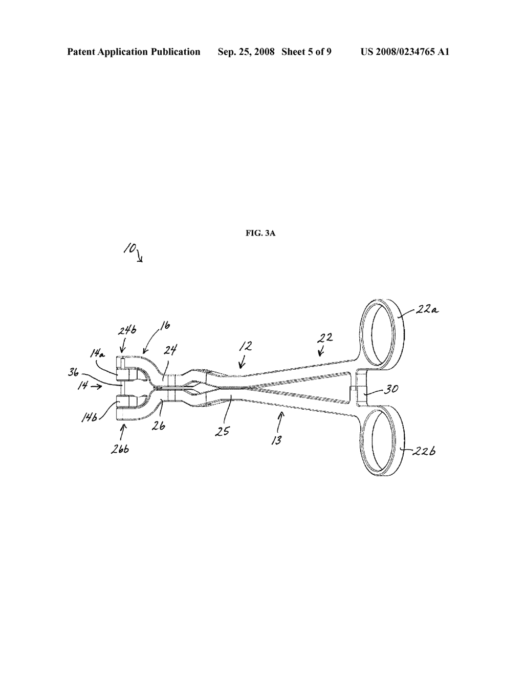 ROD REDUCTION METHODS AND DEVICES - diagram, schematic, and image 06