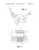 CRANIOSPINAL FUSION METHOD AND APPARATUS diagram and image