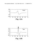 Cardiac rhythm template generation system and method diagram and image