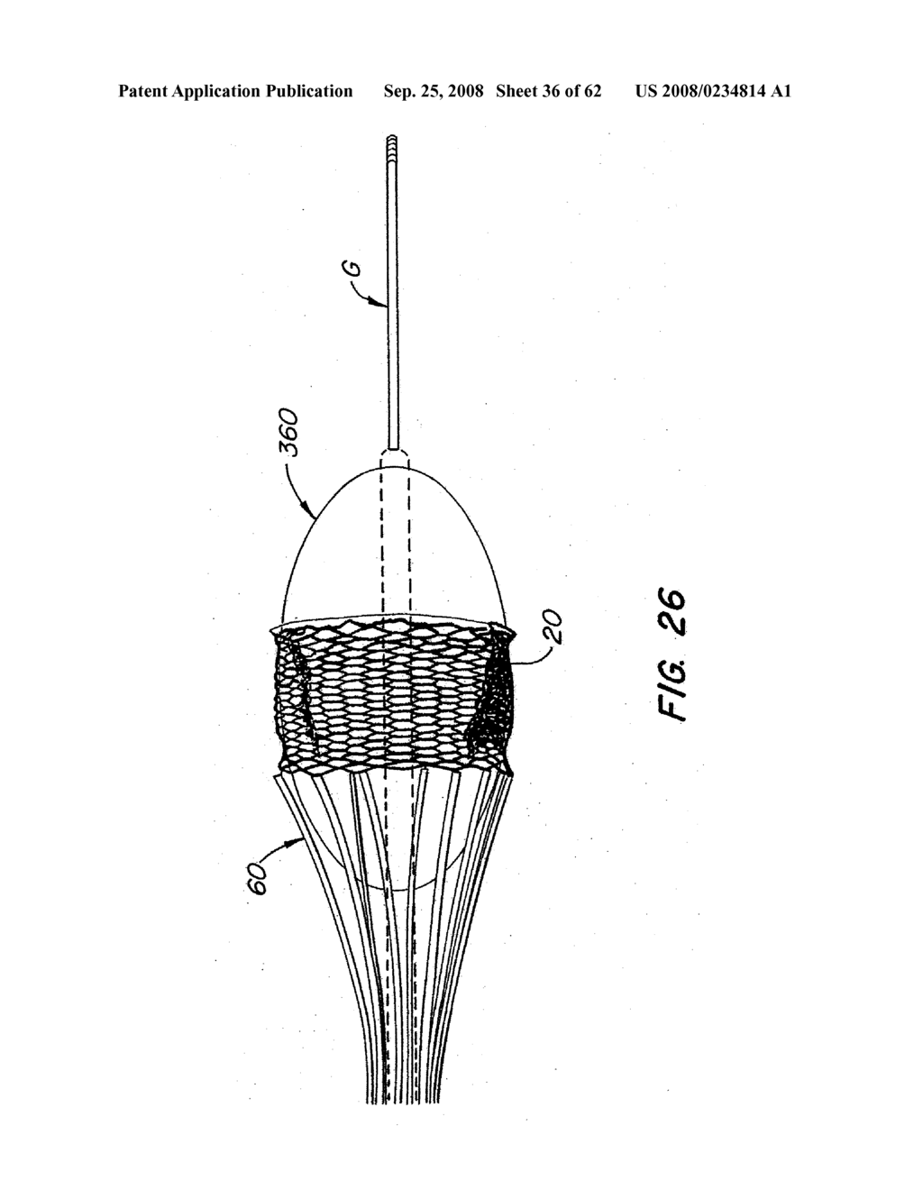 Low Profile Heart Valve and Delivery System - diagram, schematic, and image 37