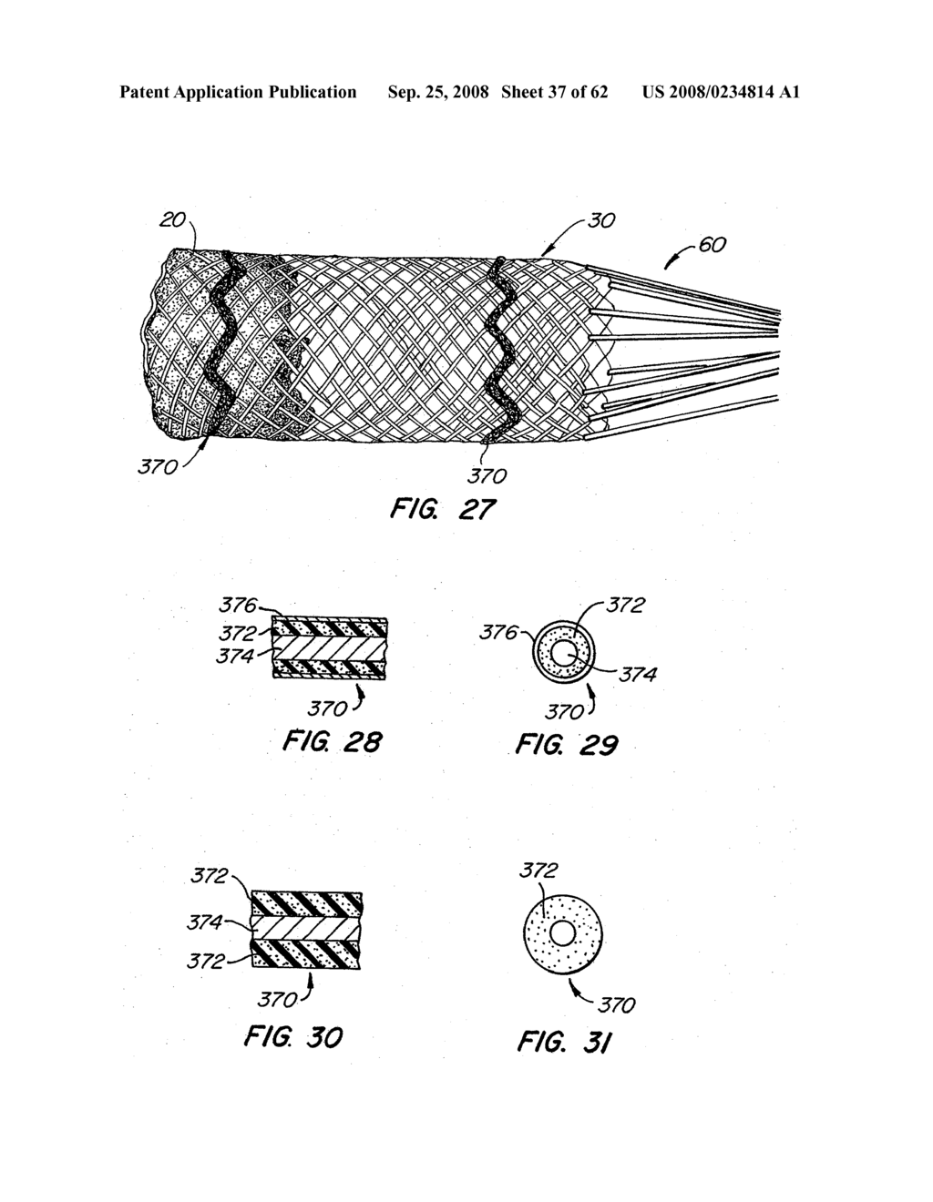 Low Profile Heart Valve and Delivery System - diagram, schematic, and image 38