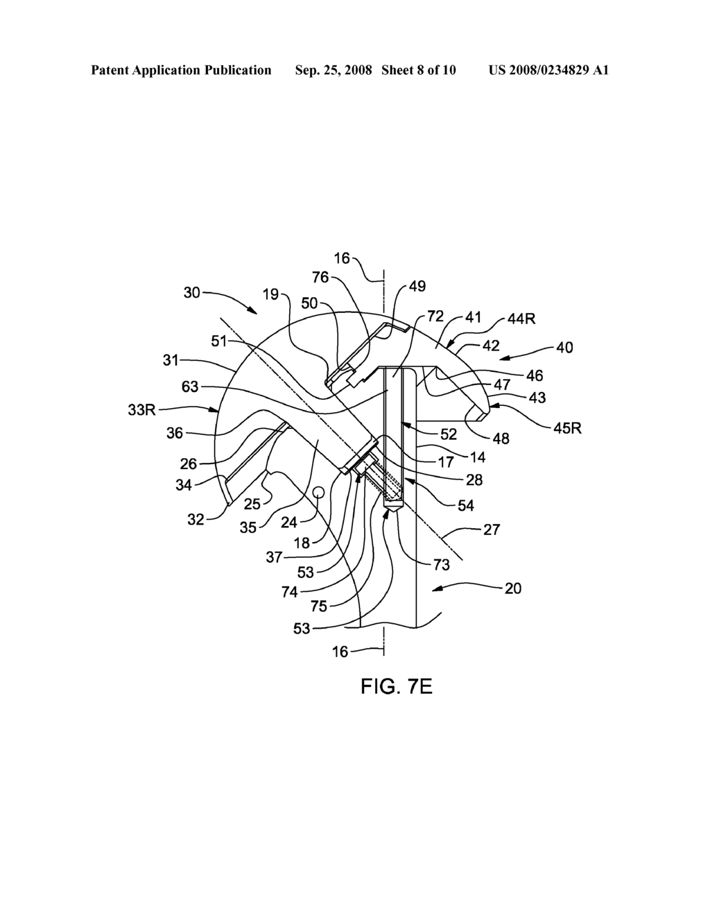 HUMERAL HEAD AUGMENT DEVICE AND METHOD FOR USE IN A SHOULDER PROSTHESIS - diagram, schematic, and image 09