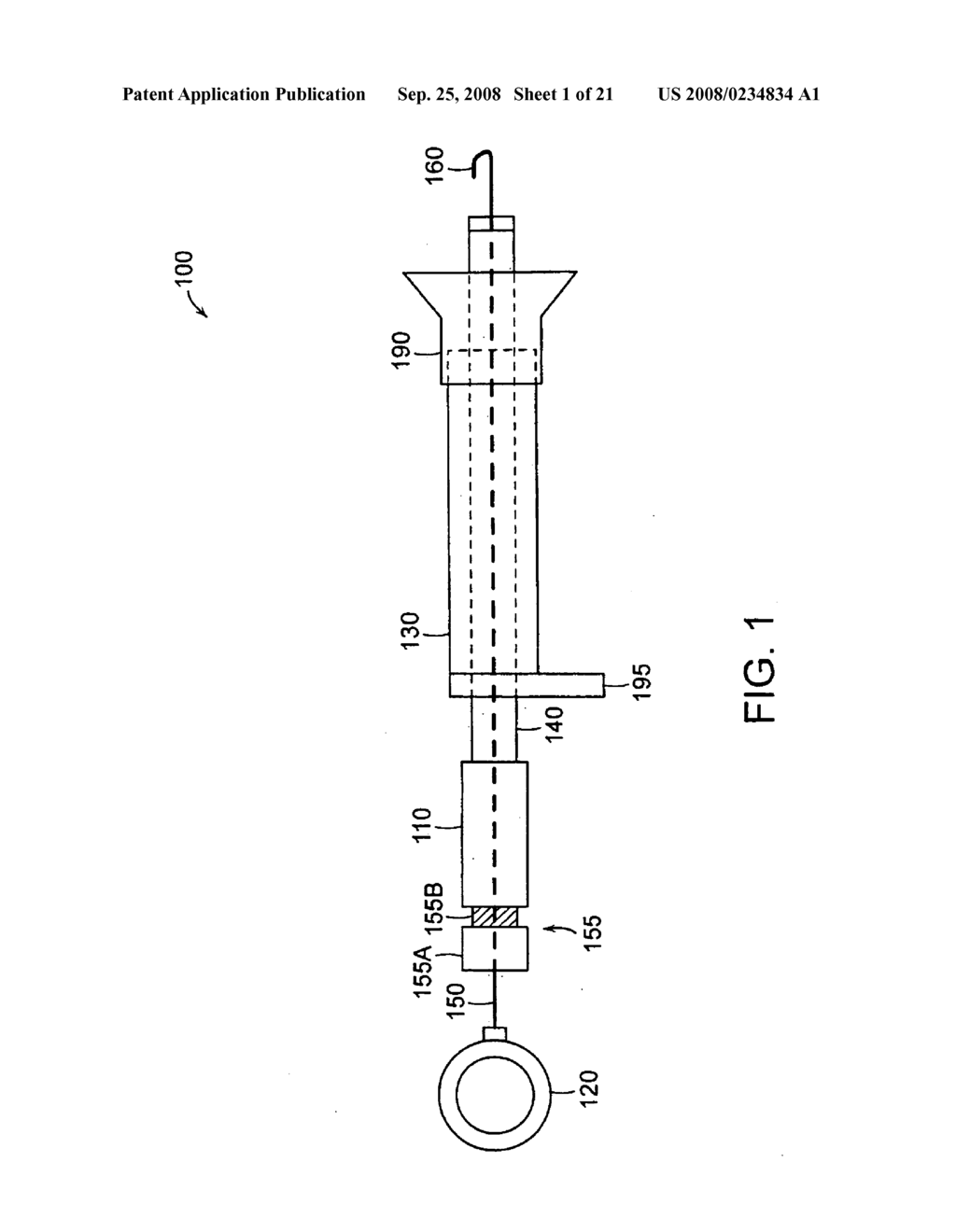 Gastrointestinal implant with drawstring - diagram, schematic, and image 02